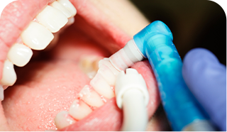 dental tool being used on patient's tooth by dental professional