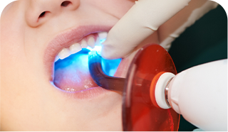 Patient receiving professional teeth whitening treatment with blue light on teeth